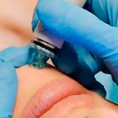 HydraFacial